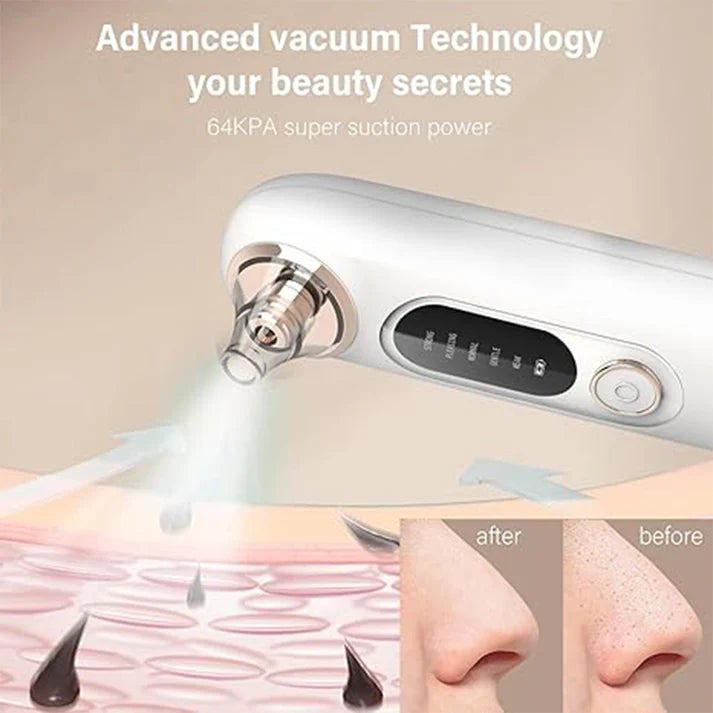 Zeyla PureLift Pore Cleaner showcasing advanced vacuum technology with 64KPA suction power for clear skin.